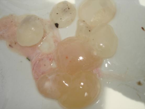 Рис. 2. Cysticercus tenuicollis на брыжейке овцы